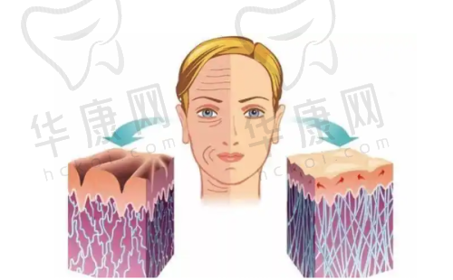 选择洛阳莱尔美整形医院刘战辉双侧耳软骨隆鼻的注意事项