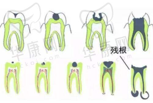 选择衡水唯美医疗美容陈海涛眼修复的注意事项