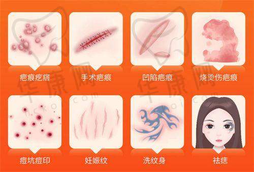 广州韩妃的风筝小拉皮手术提升下颌缘过程是怎样的？