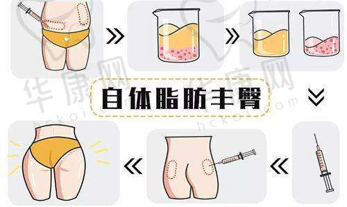 杜良军半肋鼻综合手术的实例展示