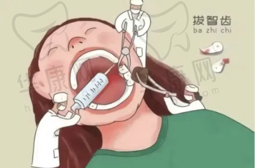 慈溪博瓦口腔阻生智齿拔除的口碑优势