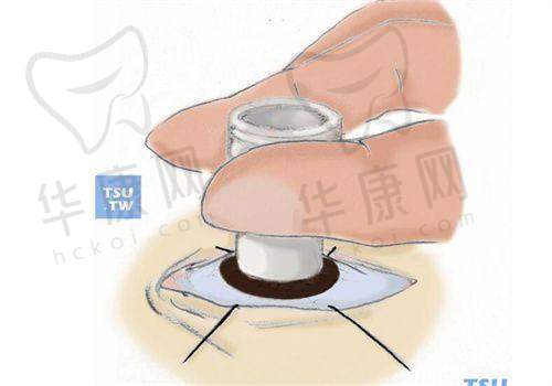 徐州复兴眼科医院好不好？服务质量如何？