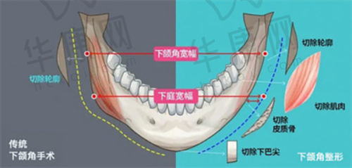 深圳阳光医院微整形收费标准合理吗?
