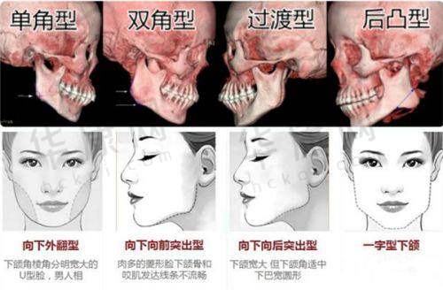 刘健医生擅长项目