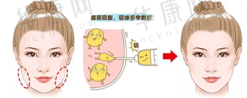 嘉兴韩辰医疗美容陈亮医生特色技术优势