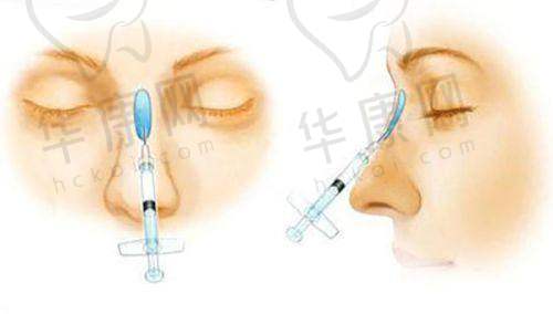 兰州韩美医疗美容杜福生吸脂的实例展示