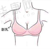 术后修复