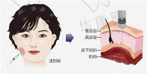 陈海涛医生在眼修复领域的特色优势