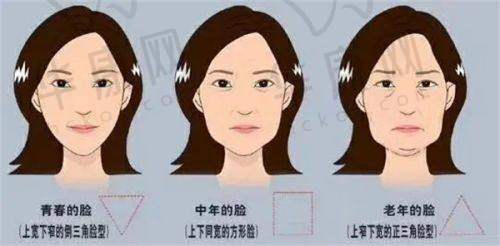 其他非凡双眼皮医生