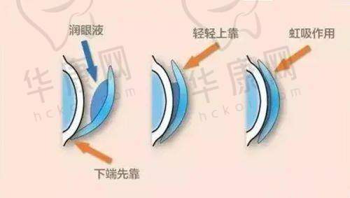 延吉爱尔眼科医院的价格与预约信息