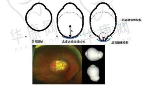北京华德眼科医院实力究竟如何?