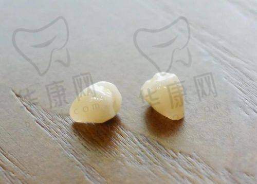 慈溪博瓦口腔全瓷冠1280元起，高性价比之选，美观耐用实惠多！