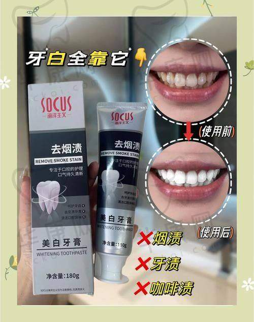 冷光美白的感受与建议