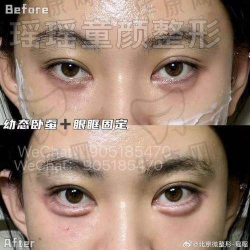 卓丽霞医生特色技术优势