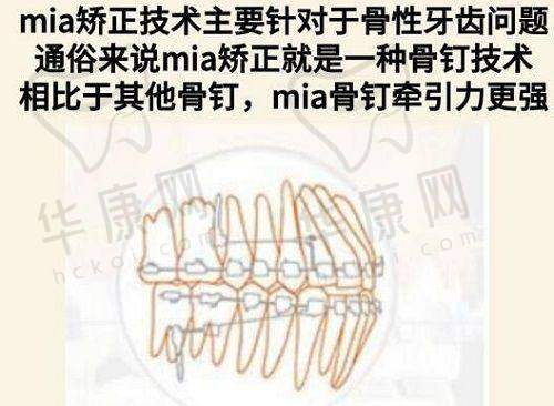 鼻综合术后第26天修复情况