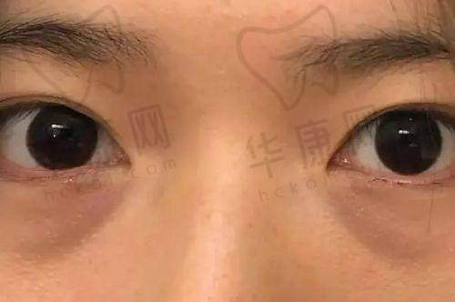 谭琳琳医生理念与风格