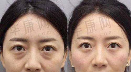 王晓健医生的专精背景与技术优势