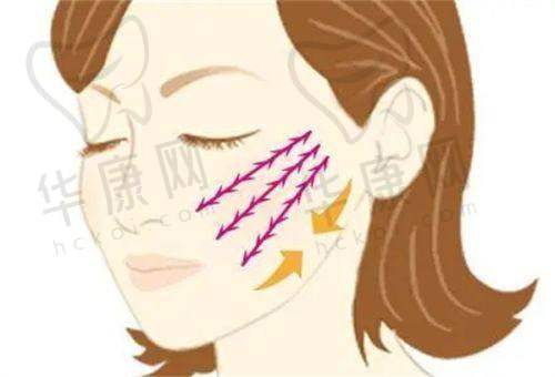 西部战区总医院烧伤整形科割双眼皮技术如何？