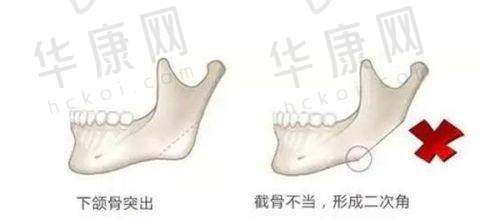 西宁时光整形美容医院在王双余上睑松弛矫正项目的优势