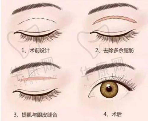 沈阳沈河腾采医疗美容门诊部口碑好吗？专业团队+优质服务赢得患者高度评价
