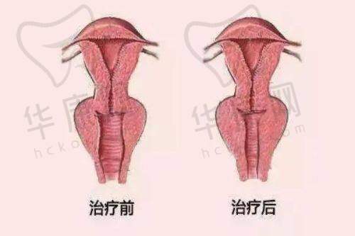 术后修复情况