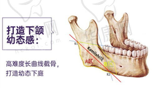 太原华美整形医院技术出色吗?
