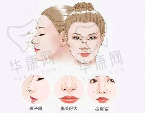 深圳福雅医疗美容范开防筋膜提升的口碑与评价