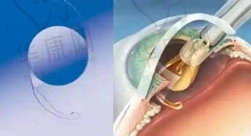 注射过程的安心体验