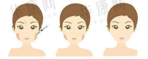 广州美莱医疗美容医院患者评价