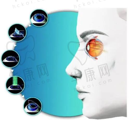 临汾洛基眼科医院星趣控项目的特色优势