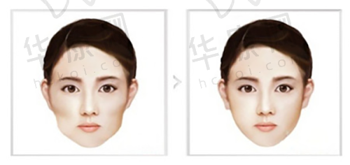 2. 成都画美整形