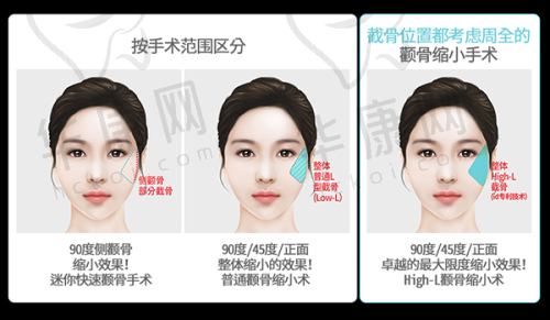 广州美莱医疗美容医院正规吗？