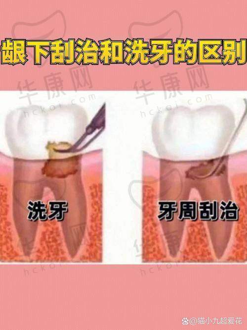 南通海门嘉仁口腔全口龈下刮治的服务特色优势