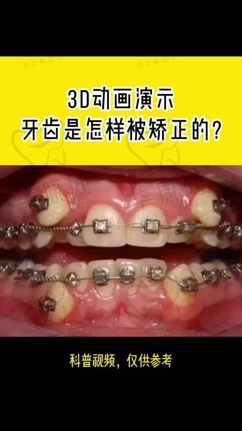 重庆南岸名博士口腔郭丽娜正雅隐形矫正的服务保护