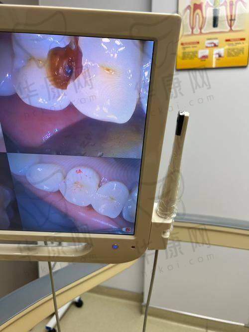 沈阳医博上诚口腔国产树脂补牙的未来展望