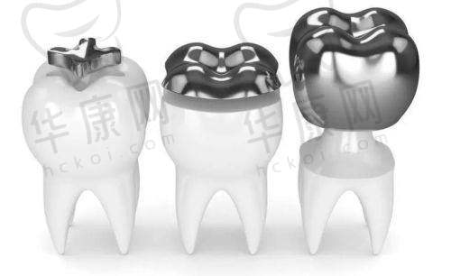 北海柏乐口腔嵌体修复1342元起，专业团队带来精准高效的牙齿修复体验！