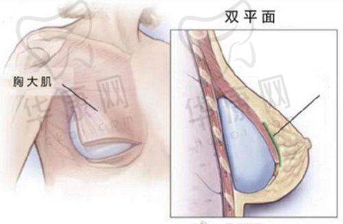 杭州格莱美隆胸，开展哪些特色项目？
