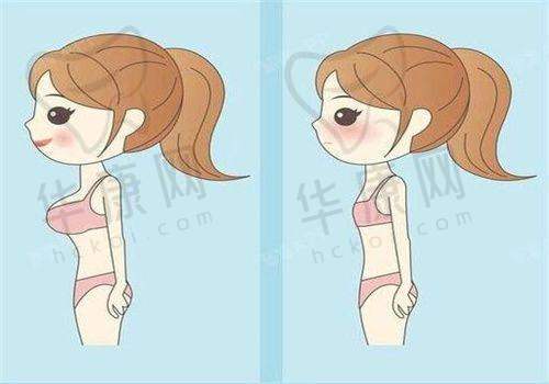 北京做鼻子自然靠谱的医生实例如何?
