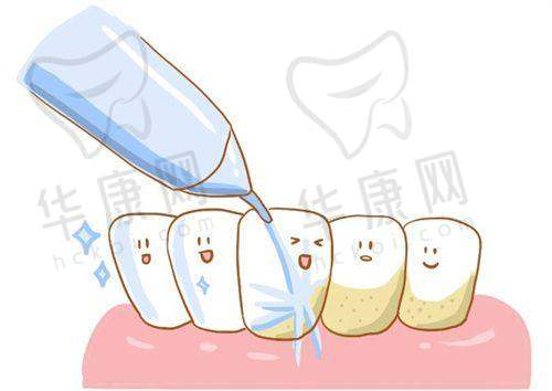 达州医大口腔医院龈下刮治的性价比优势