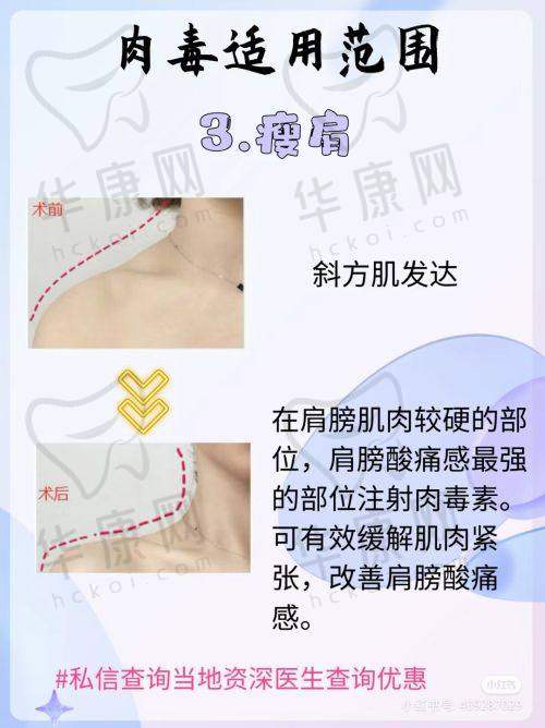成都军大整形外科医院刘绪立自体脂肪填充之技术优势