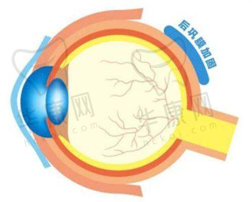 苏州眼耳鼻喉科医院眼科全飞秒手术的患者评价