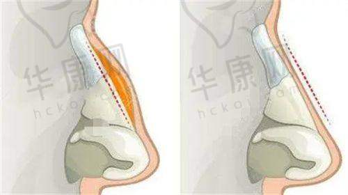 术后修复情况