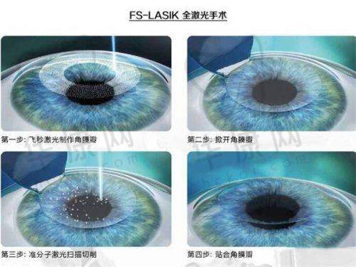 治疗方案:个性化定制与专精讲解
