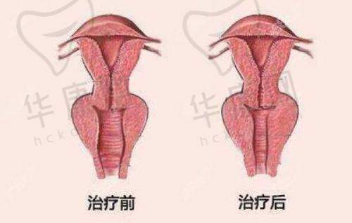 邵菊丽医生:胸部整形领域的佼佼者