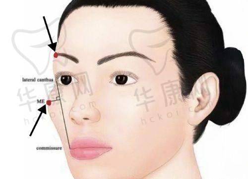 手术过程与感受