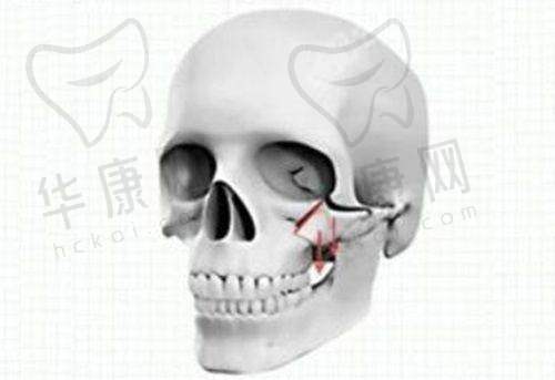 周霖医生在眼整形项目方面的特色优势