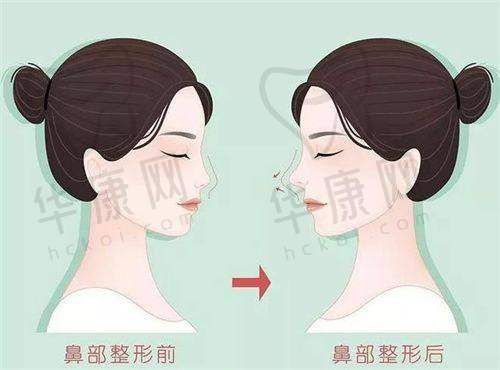 东莞莞城美立方美容医院在腰腹环吸方面的特色优势