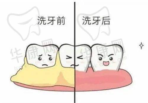 长沙松鼠口腔全口龈下刮治的设备支持