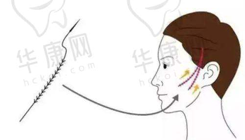 龙海波医生的口碑评价