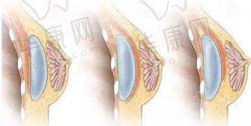 术后修复与成效呈现